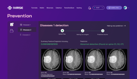 Diagnosing a number of diseases that has set in two "lines: AI Prediction & AI Chatbot